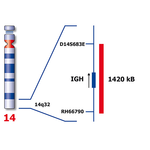RUO - CCND1 / IGH Fusion product photo Side View S