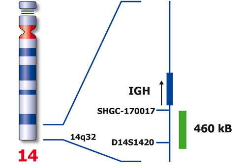 IGH (14q32) XL product photo Front View S