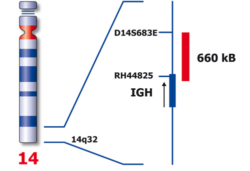 IGH (14q32) XL product photo Back View S