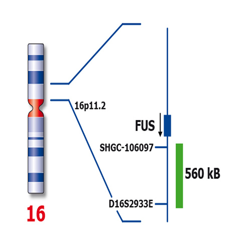 FUS (16p11) Break – XL product photo Front View S