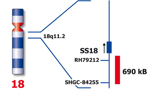 SS18 (18q11) Distal - XL product photo Front View S