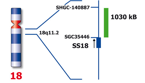 SS18 (18q11) Distal - XL product photo Back View S