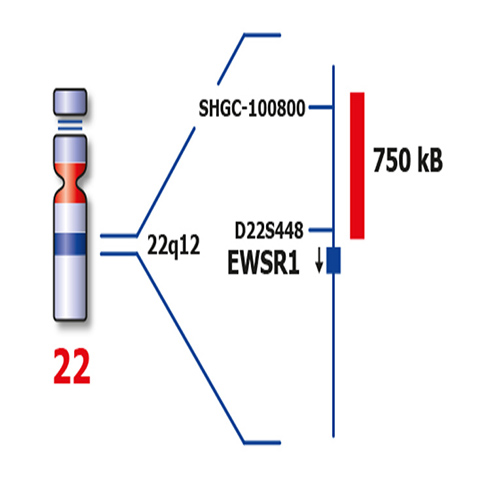 EWSR1 (22q12)  - XL product photo Front View S