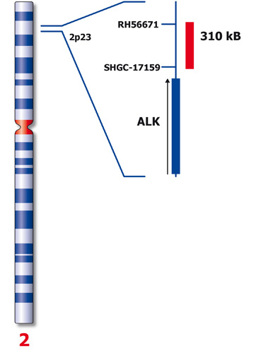 ALK (2p23) product photo Back View S