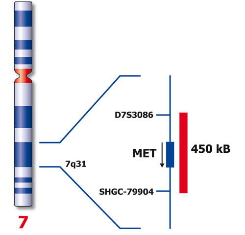 MET (7q31) Red 50µl 2x product photo