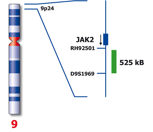JAK2 (9p24) Distal Red 50µl 2x product photo