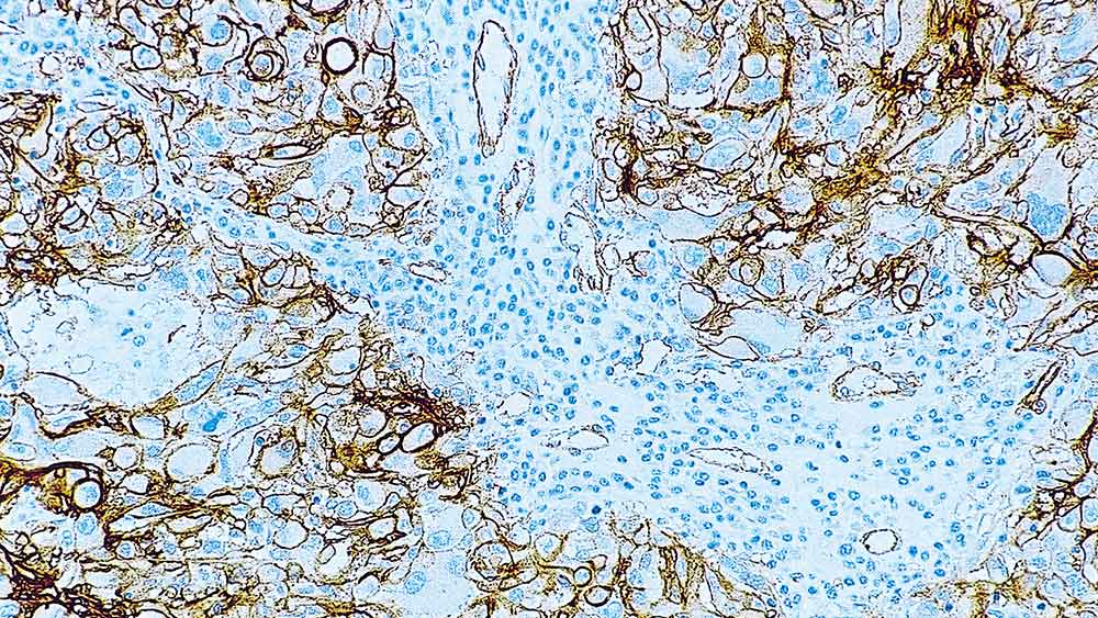 CD146 (MCAM) product photo Front View S