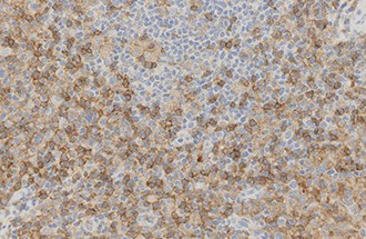 CD4 product photo Front View S