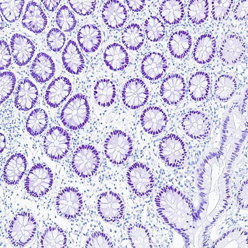 AP purple Chromogen product photo Top View S