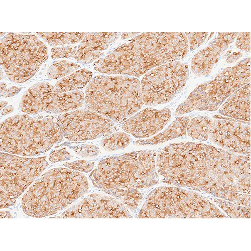Calcitonin product photo