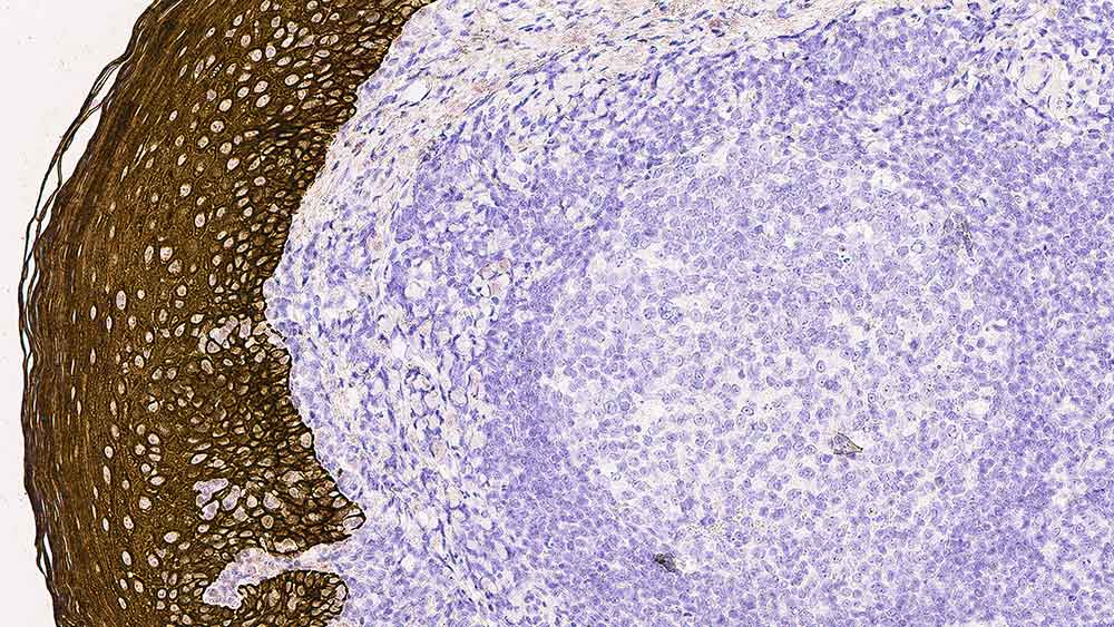 Cytokeratin, Multi (4/5/6/8/10/13/18) product photo Front View S