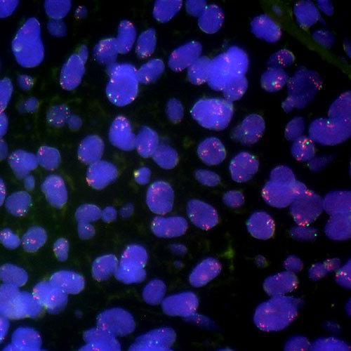 FGFR1 product photo Front View S