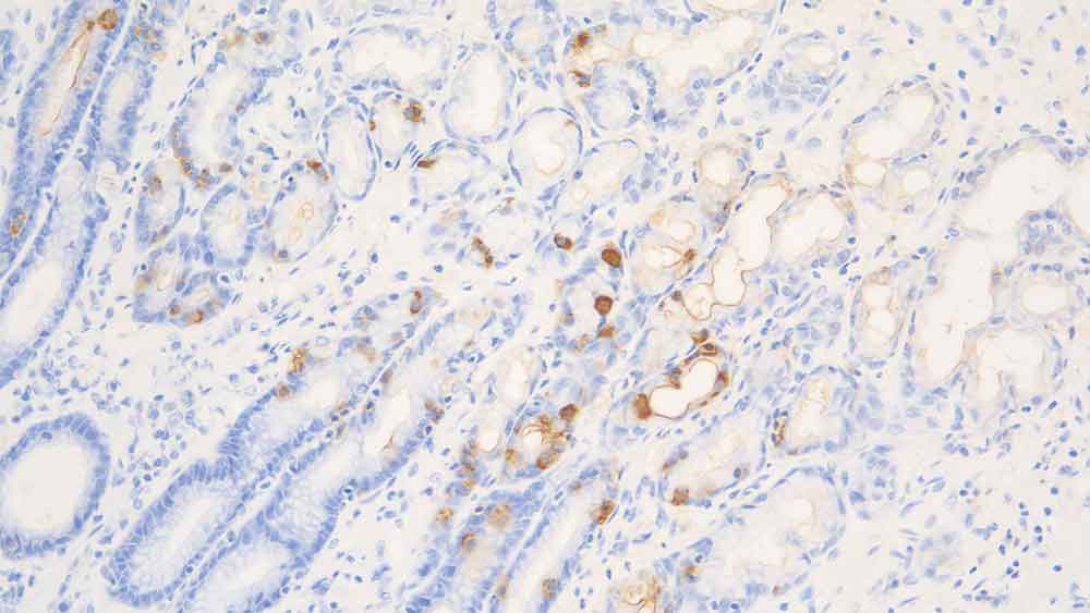 Gastrin product photo