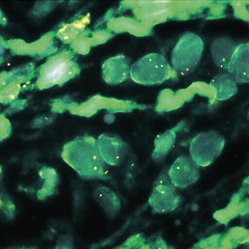 RUO - MALT1 Break (tissue) (18q21) product photo Front View S