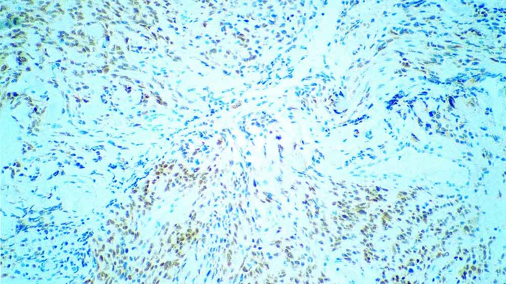 MyoD1 (Rhabdomyosarcoma Marker) product photo Front View S