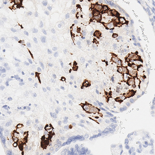 ACD RNA Probe - CMV product photo