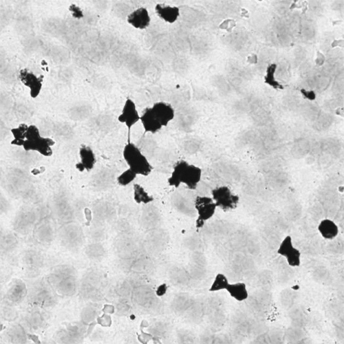 ACD RNA Probe - EBV product photo Front View S