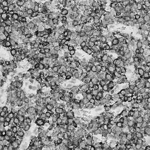 ACD RNA Probe - Albumin product photo Front View S