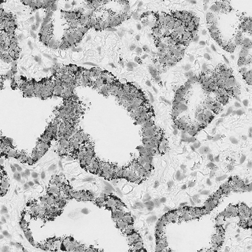 ACD RNA ISH Probe Napsin A product photo Front View S