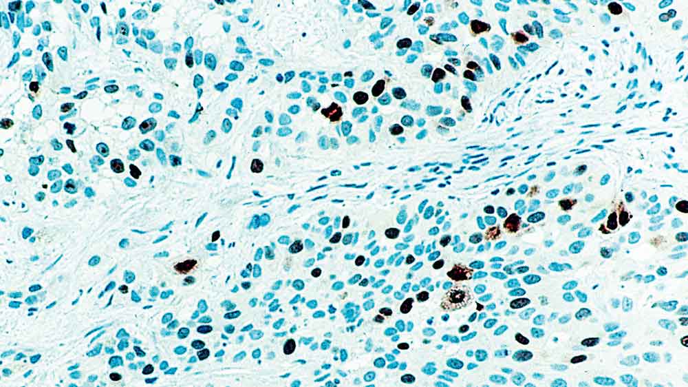 Topoisomerase II Alpha product photo Front View S
