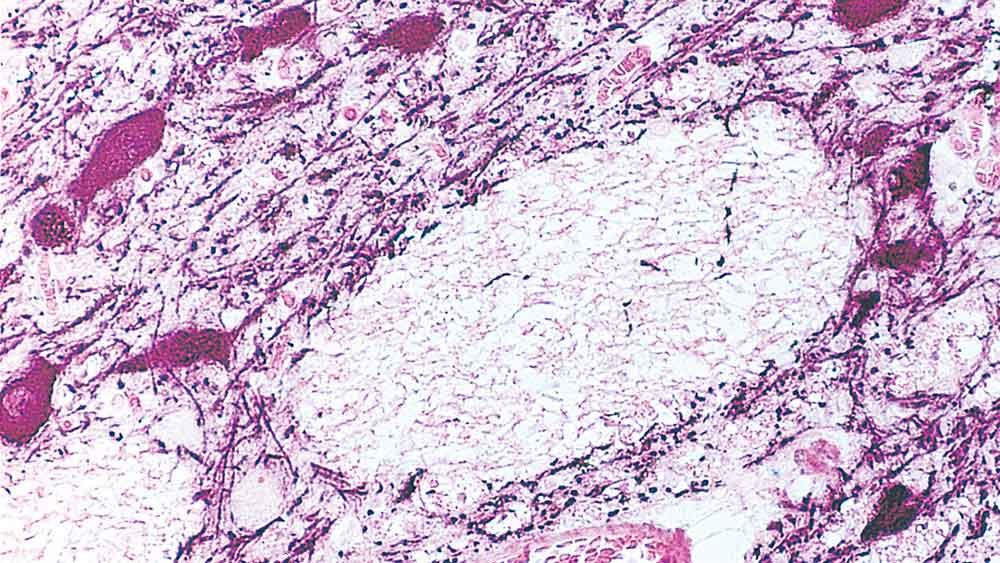 Tyrosine Hydroxylase product photo Front View S