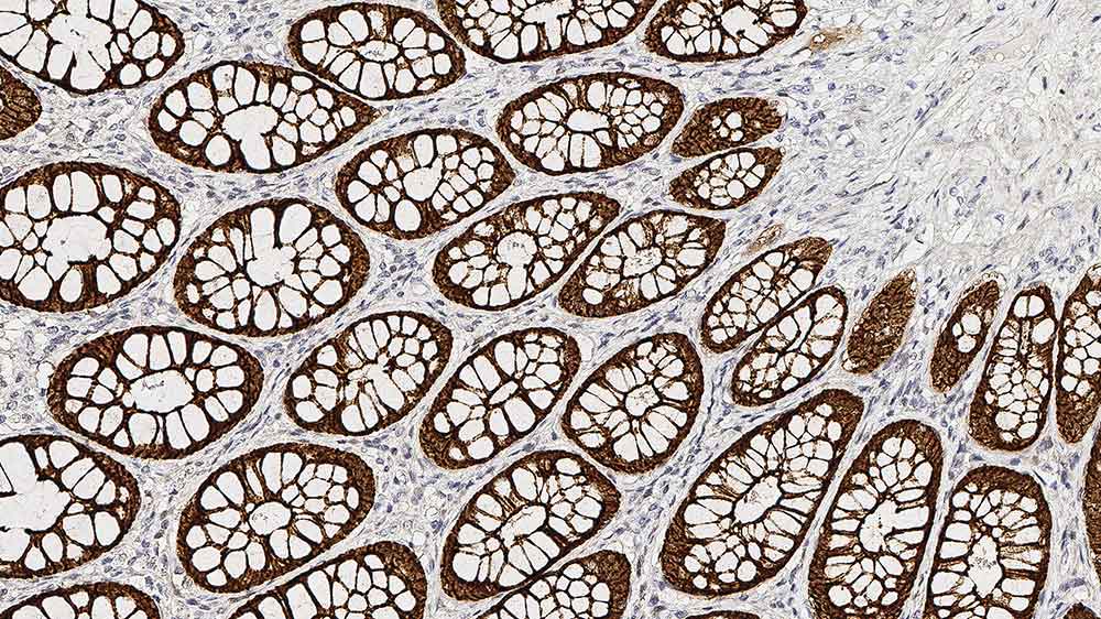 Villin product photo Front View S