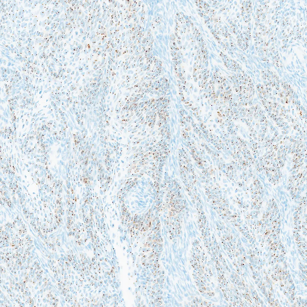 BOND-PRIME RNAscope® Brown Detection System product photo Front View S