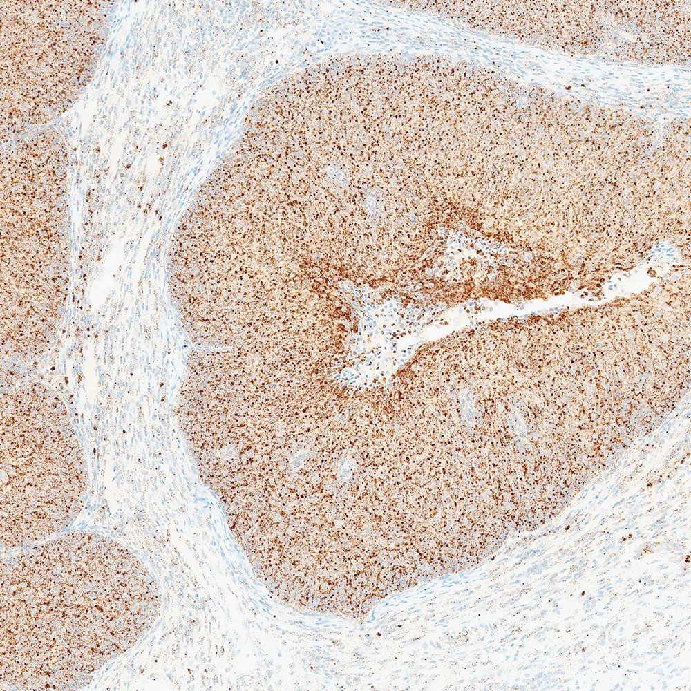 BOND-PRIME RNAscope® Brown Detection System product photo Inner View S