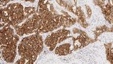 0.5ml NCL-L-ALK product photo